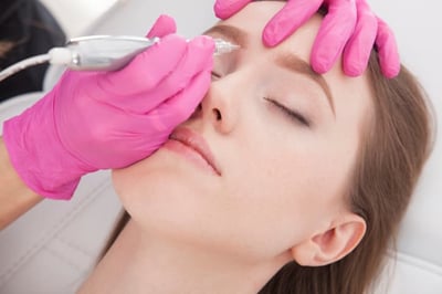 métodos para sacar las cejas electrolisis para depilación