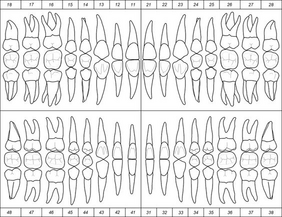 periodontograma